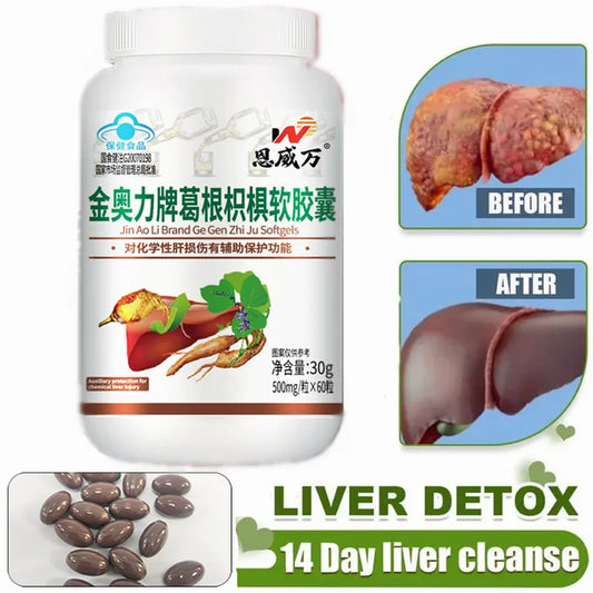 Liver Detox Cleanse Capsules - Improve Liver Function, Remove Toxins, Support Gallbladder Health