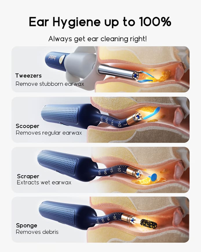 How Ear Scope Pro Can Be a Game-Changer for Sinus Problems